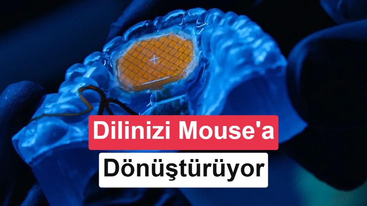 MouthPad: A Revolutionary Way to Control Technology with Tongue Movements